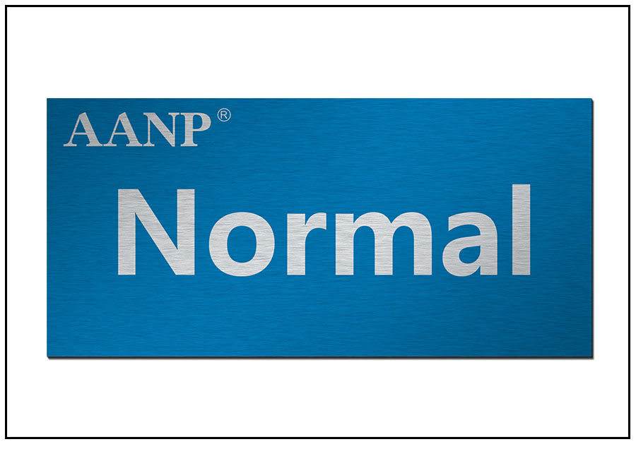 產(chǎn)線標(biāo)識鋁銘牌